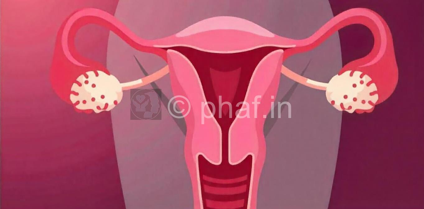 PCOD (Polycystic Ovarian Disease)