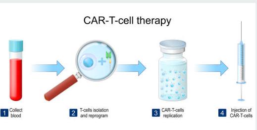Landscape of CAR T Cell Therapy Market in Today’s Era