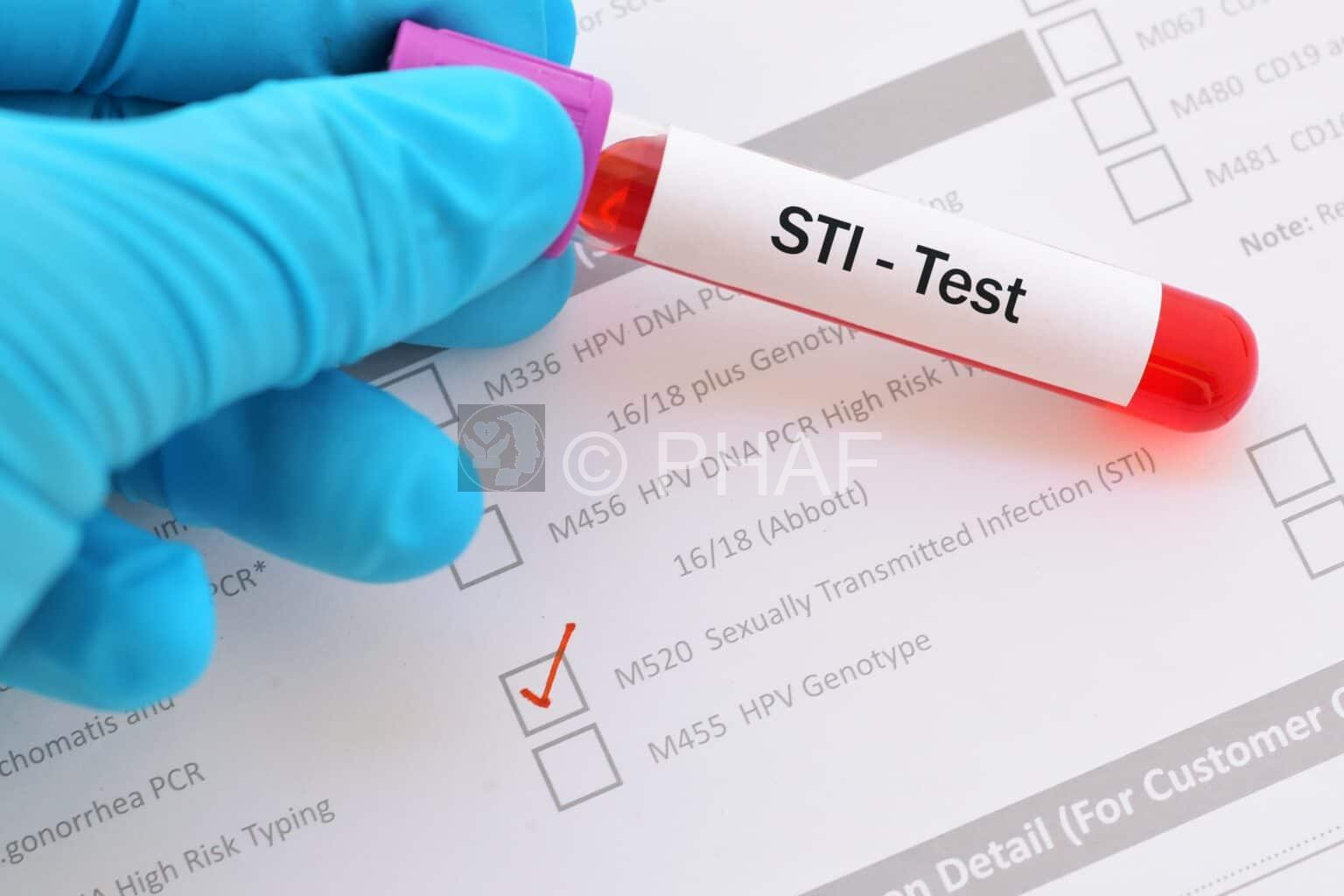 The Importance of Regular STI Testing and How to Get Tested